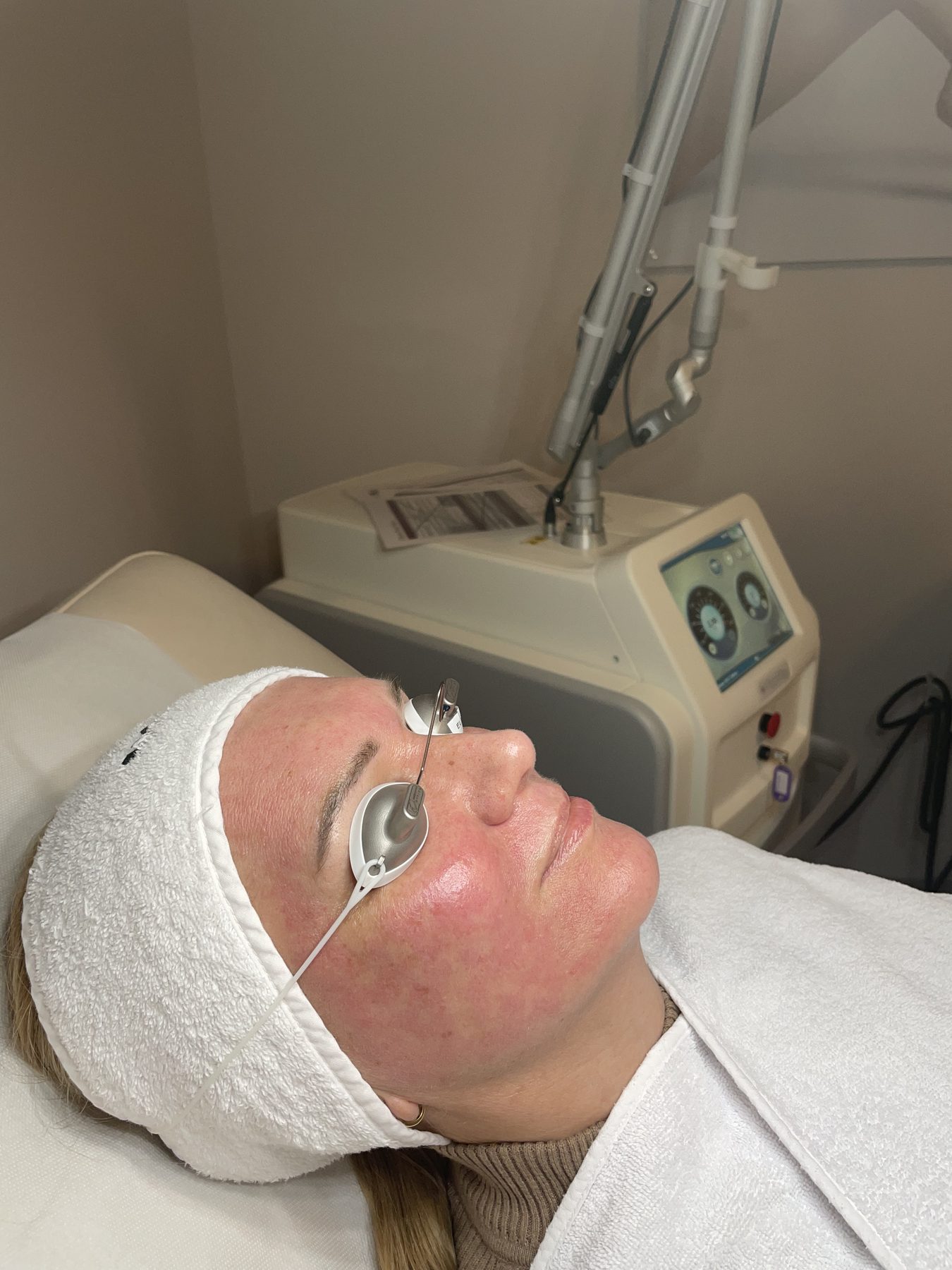 Laser Pigmentflecken Bad Homburg - Praxis D.