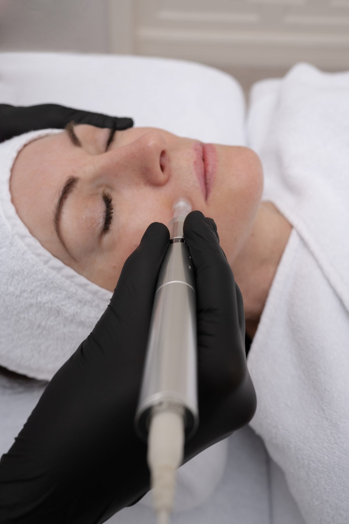 Microneedling Behandlungspaket Bad Homburg - Praxis D.