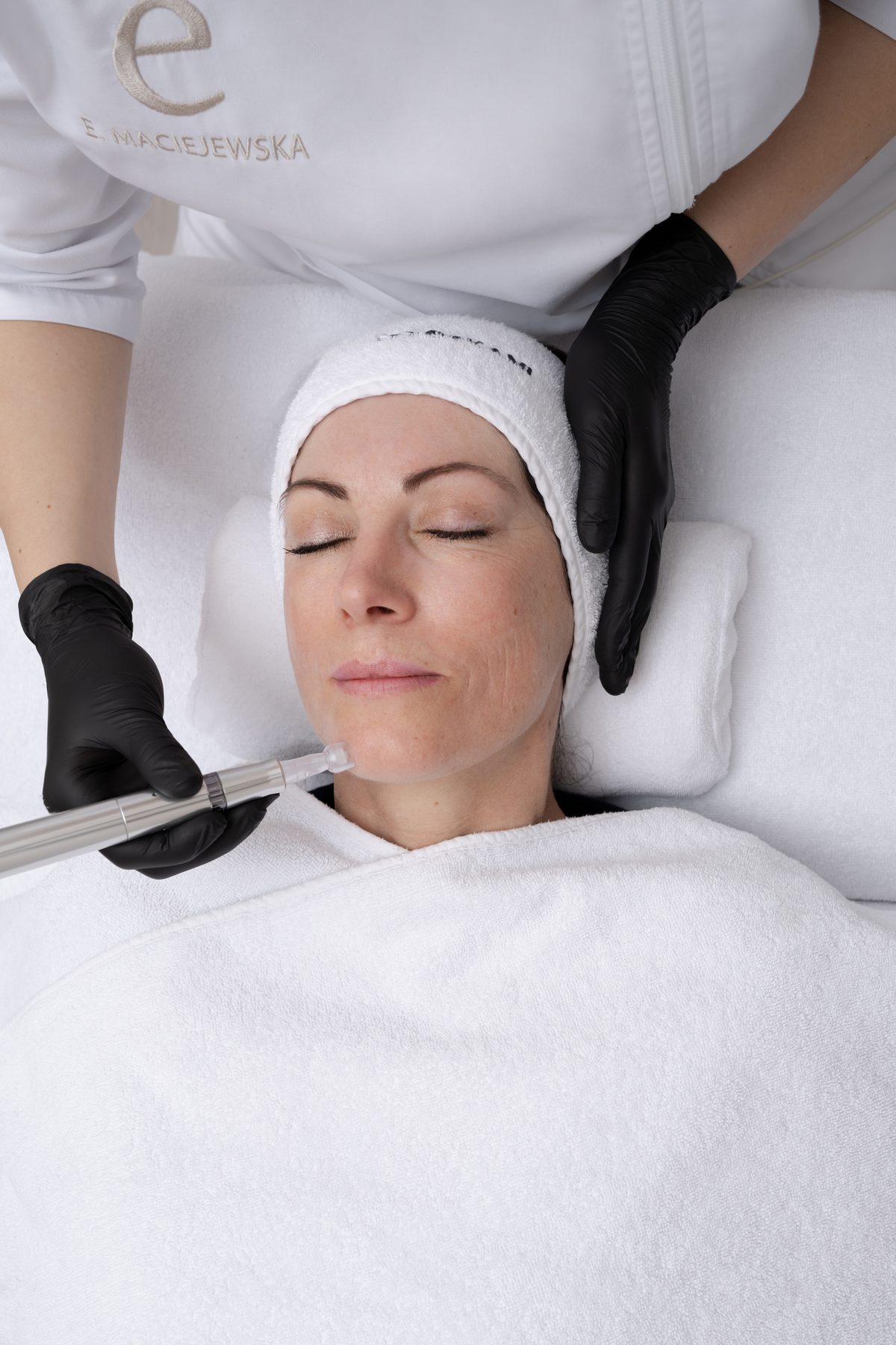 Microneedling Bad Homburg - Praxis D.